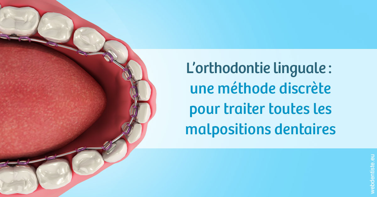 https://dr-hassid-jacques.chirurgiens-dentistes.fr/L'orthodontie linguale 1