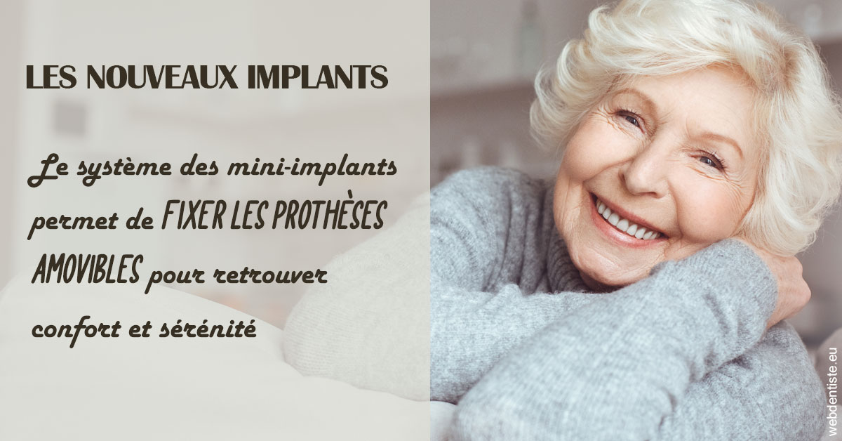 https://dr-hassid-jacques.chirurgiens-dentistes.fr/Les nouveaux implants 1