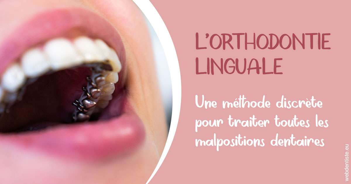 https://dr-hassid-jacques.chirurgiens-dentistes.fr/L'orthodontie linguale 2
