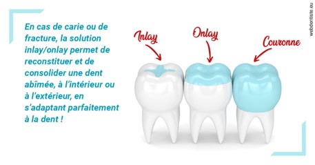 https://dr-hassid-jacques.chirurgiens-dentistes.fr/L'INLAY ou l'ONLAY
