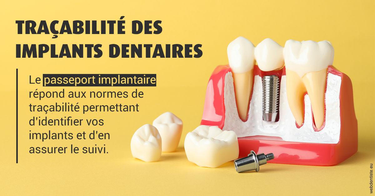 https://dr-hassid-jacques.chirurgiens-dentistes.fr/T2 2023 - Traçabilité des implants 2