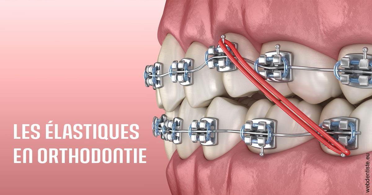 https://dr-hassid-jacques.chirurgiens-dentistes.fr/Elastiques orthodontie 2