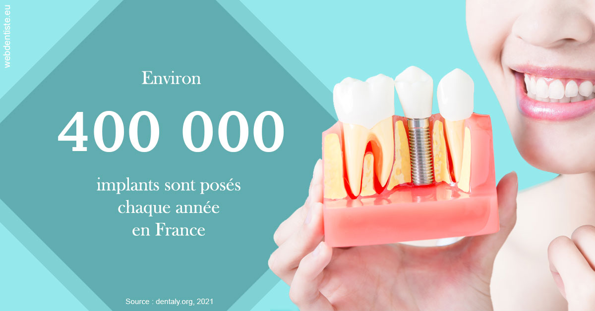 https://dr-hassid-jacques.chirurgiens-dentistes.fr/Pose d'implants en France 2